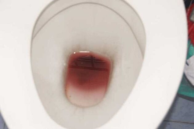 当男人兴奋时发现他们